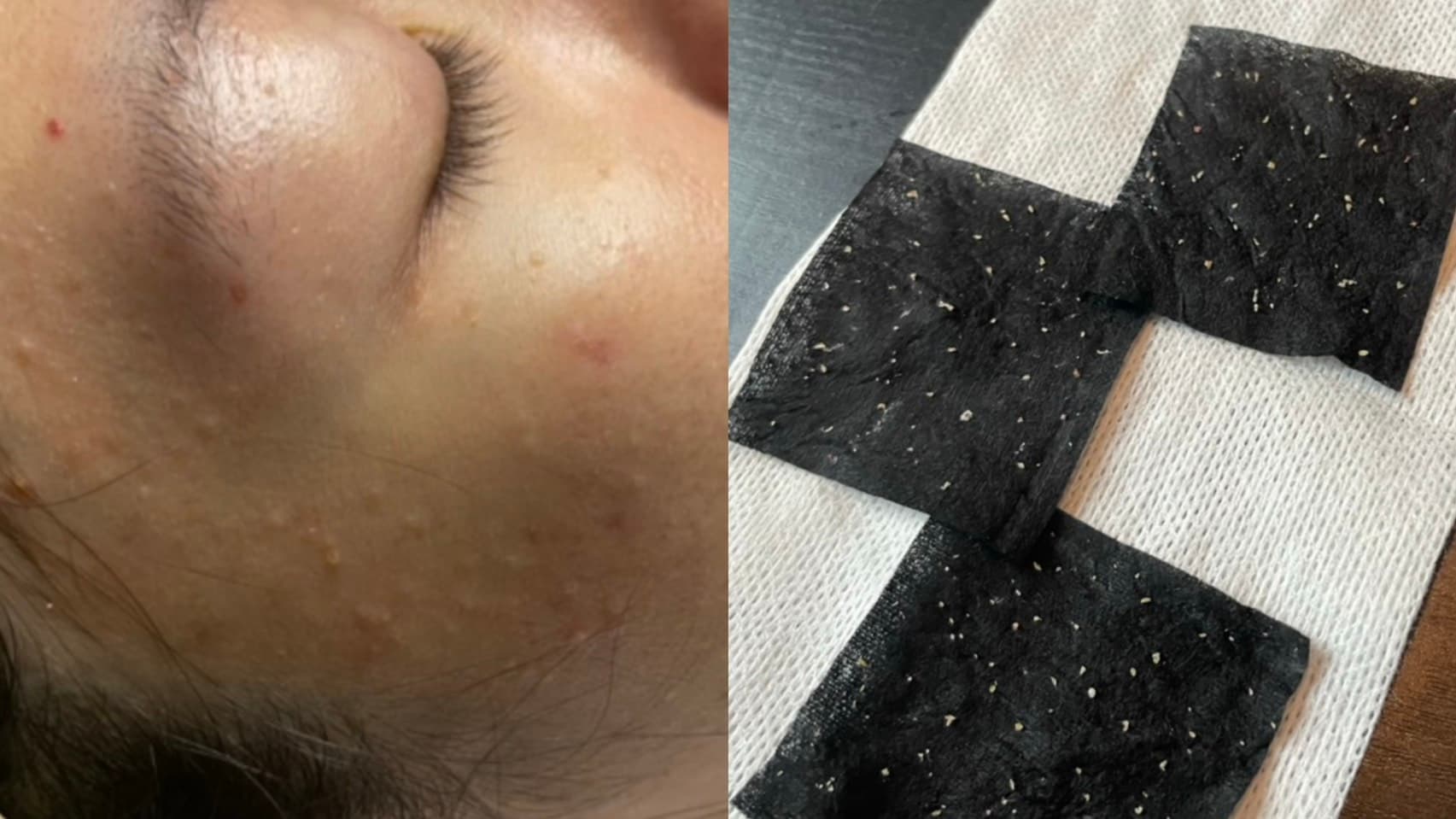 Lazy Skincare_02